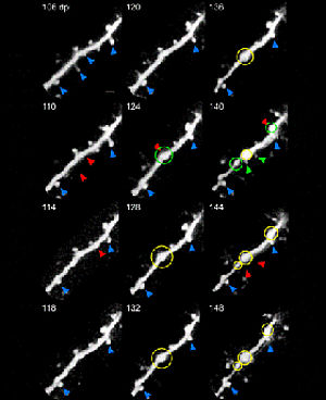 Prionprotein an hippocampalen exzitatorischen Synapsen